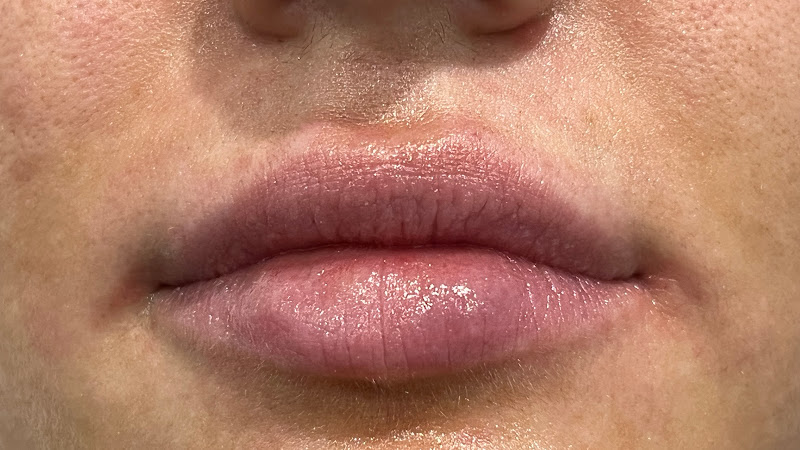 Hoboken Cosmetic & Laser Center
