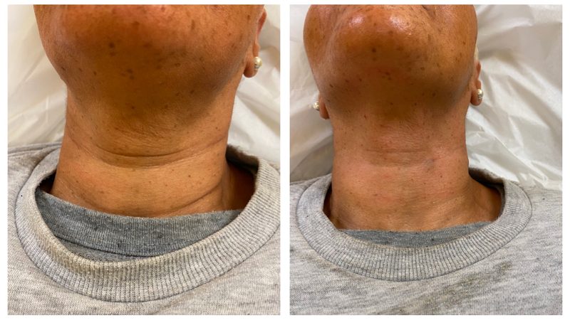 Skin Esteem by B. Beckford, Nurse Practitioner