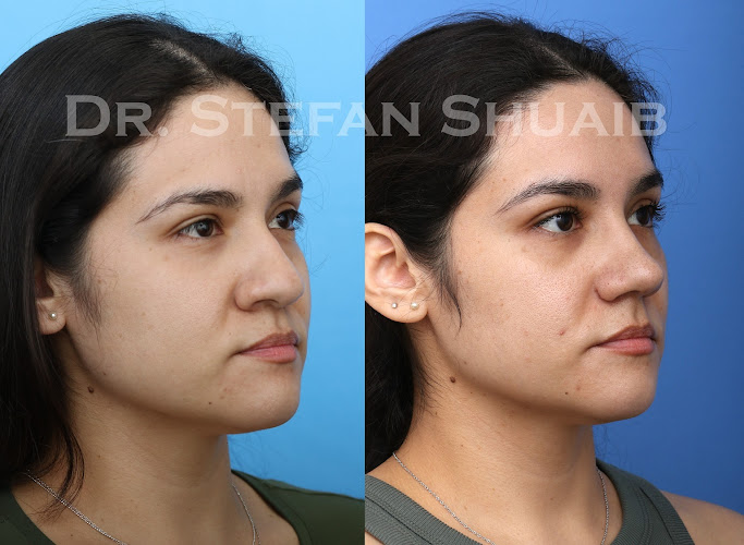 Dallas Facial Plastic Surgery Center: Dr. Stefan Shuaib