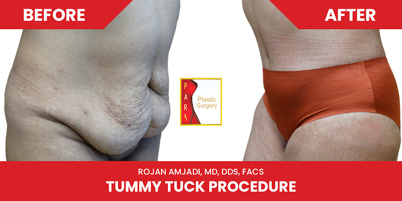 PARS Plastic Surgery