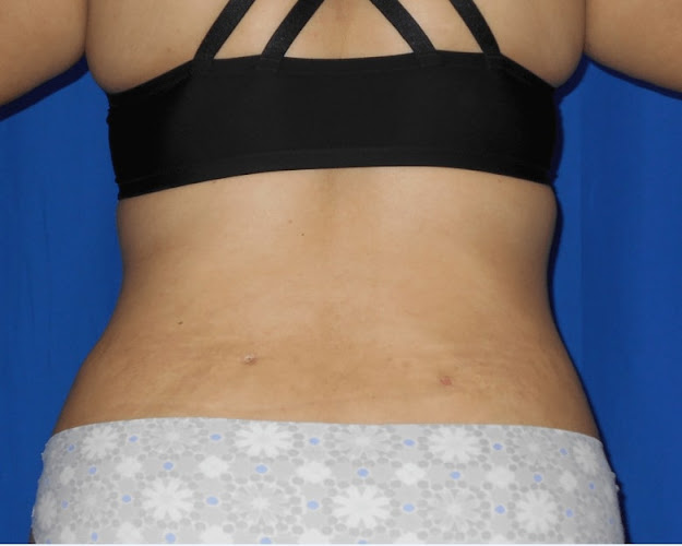 Rios Center For Plastic Surgery
