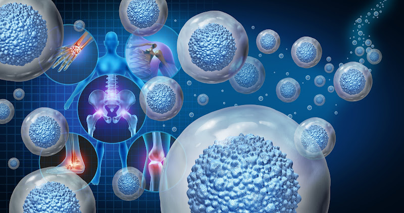 North Texas Musculoskeletal Medicine – Stem Cell Therapy Dallas