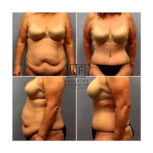 Bancroft Gregory N MD