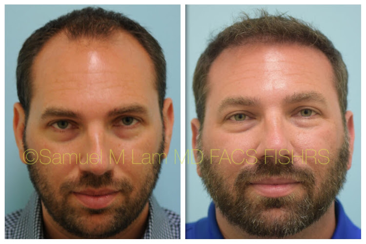 Samuel M. Lam, MD, FACS – Lam Facial Plastics