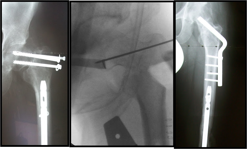 Orthopedic Surgery